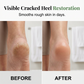 👣🔥🌿 Cuidados com os pés com óleo natural de árvore do chá ✨ Cuidados diários refrescantes, nutritivos e suaves para pés macios e suaves 💚