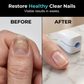 🥳PROMOÇÃO IMPERDÍVEL 2026🥳💞Mais de 50.000 unidades vendidas!👵❤️ 50% de desconto! Aparelho portátil para cuidados com as unhas com luz azul