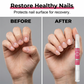 💅Desconto de 50% no último dia🚫👄Prevenção de roer unhas para crianças e adultos
